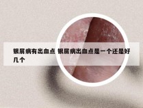 银屑病有出血点 银屑病出血点是一个还是好几个