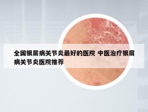 全国银屑病关节炎最好的医院 中医治疗银屑病关节炎医院推荐
