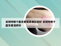 皮研所哪个医生看银屑病比较好 皮研所哪个医生看湿疹好