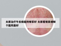 太原治疗牛皮癣医院哪家好 太原看银屑病哪个医院最好