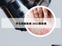 罕见病银屑病 2021银屑病