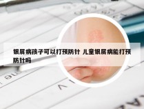 银屑病孩子可以打预防针 儿童银屑病能打预防针吗