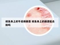 鲸鱼身上的牛皮癣藤壶 鲸鱼身上的藤壶能去除吗