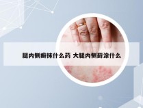 腿内侧癣抹什么药 大腿内侧藓涂什么
