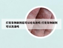 打完生物制剂后可以吃头孢吗 打完生物制剂可以洗澡吗