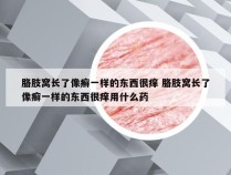 胳肢窝长了像癣一样的东西很痒 胳肢窝长了像癣一样的东西很痒用什么药