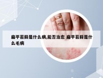 扁平苔藓是什么病,能否治愈 扁平苔藓是什么毛病