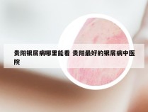 贵阳银屑病哪里能看 贵阳最好的银屑病中医院