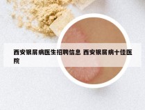 西安银屑病医生招聘信息 西安银屑病十佳医院