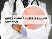 宝贝脸上一块块的白什么情况 宝宝脸上一块儿白一块儿白