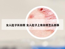 女人肚子长白斑 女人肚子上有白斑怎么回事