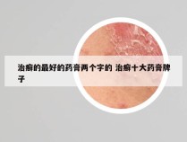 治癣的最好的药膏两个字的 治癣十大药膏牌子
