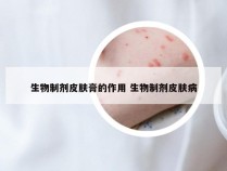 生物制剂皮肤膏的作用 生物制剂皮肤病