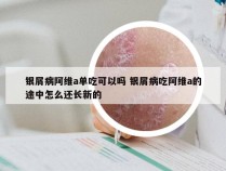 银屑病阿维a单吃可以吗 银屑病吃阿维a的途中怎么还长新的
