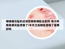 喉咙痛引起的点滴型银屑病能治愈吗 嗓子疼银屑病又起疙瘩了!半月之后颜色变暗了是要好吗