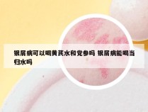 银屑病可以喝黄芪水和党参吗 银屑病能喝当归水吗