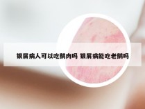 银屑病人可以吃鹅肉吗 银屑病能吃老鹅吗