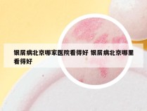银屑病北京哪家医院看得好 银屑病北京哪里看得好