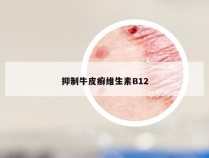 抑制牛皮癣维生素B12