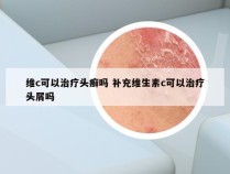维c可以治疗头癣吗 补充维生素c可以治疗头屑吗