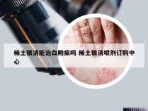 稀土银消能治白殿疯吗 稀土银消喷剂订购中心