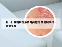 第一针生物制剂多长时间见效 生物制剂打一针管多久