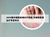 2004版中国银屑病诊疗指南 中国银屑病治疗专家共识