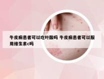 牛皮癣患者可以吃叶酸吗 牛皮癣患者可以服用维生素c吗