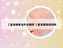 芐星青梅素治牛皮癣吗 芐星青霉素的功效