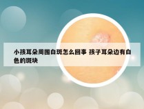 小孩耳朵周围白斑怎么回事 孩子耳朵边有白色的斑块