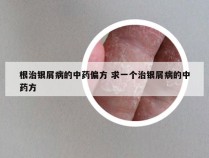 根治银屑病的中药偏方 求一个治银屑病的中药方