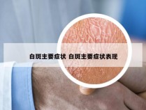 白斑主要症状 白斑主要症状表现