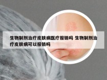 生物制剂治疗皮肤病医疗报销吗 生物制剂治疗皮肤病可以报销吗