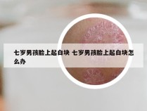 七岁男孩脸上起白块 七岁男孩脸上起白块怎么办