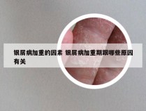 银屑病加重的因素 银屑病加重期跟哪些原因有关