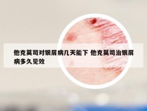 他克莫司对银屑病几天能下 他克莫司治银屑病多久见效