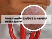 郑州最好的皮肤科医院是哪家 郑州最好的皮肤科医院是哪家啊