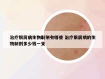 治疗银屑病生物制剂有哪些 治疗银屑病的生物制剂多少钱一支