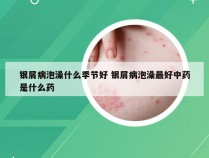 银屑病泡澡什么季节好 银屑病泡澡最好中药是什么药