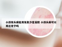 小孩有头癣能用氧氟沙星凝胶 小孩头癣可以用达克宁吗