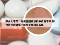 郑州大学第一附属医院皮肤科牛皮癣专家 郑州大学附属第一医院皮肤科怎么样