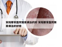 安阳那家医院银屑病治的好 安阳那家医院银屑病治的好些