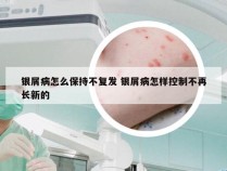 银屑病怎么保持不复发 银屑病怎样控制不再长新的