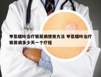 甲氨蝶呤治疗银屑病使用方法 甲氨蝶呤治疗银屑病多少天一个疗程