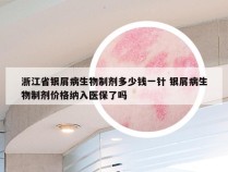 浙江省银屑病生物制剂多少钱一针 银屑病生物制剂价格纳入医保了吗