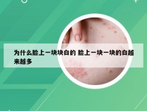 为什么脸上一块块白的 脸上一块一块的白越来越多