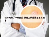 颧骨处长了个癣图片 颧骨上长疙瘩是怎么回事