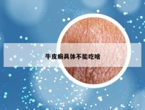 牛皮癣具体不能吃啥