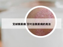 艾绒银屑病 艾叶治银屑病的用法