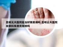 昆明元大医院能治好银屑病吗 昆明云大医院皮肤科有激光祛斑吗